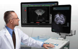 ביופסיית ערמונית מבוססת Mri ביופסיית פיוז ן בית חולים הרצליה